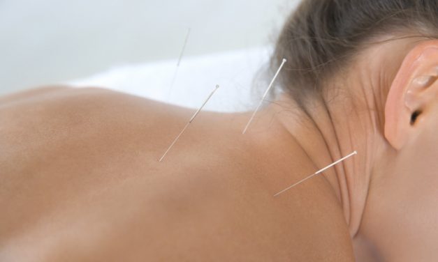 Acupuncture Fibromyalgia Relief Confirmed