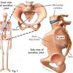 Sacroiliac Joints And Chiropractic