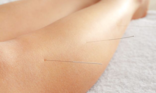 Acupuncture Knee Arthritis Treatments Found Effective