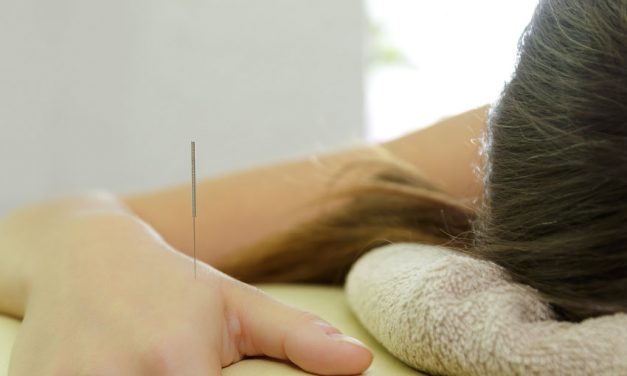 Acupuncture Migraine Relief Confirmed In Laboratory Investigation