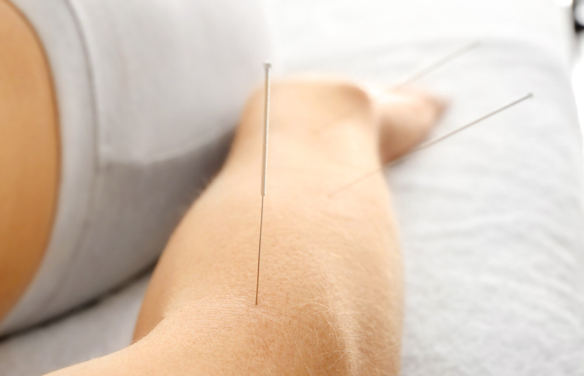 Acupuncture Promotes Bone Fracture Recovery