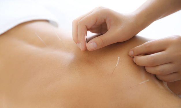 Acupuncture Top 3 Treatments
