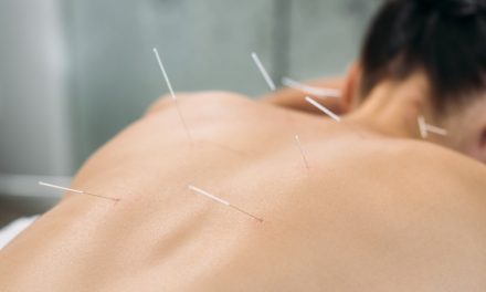 Uses and Benefits of Acupuncture